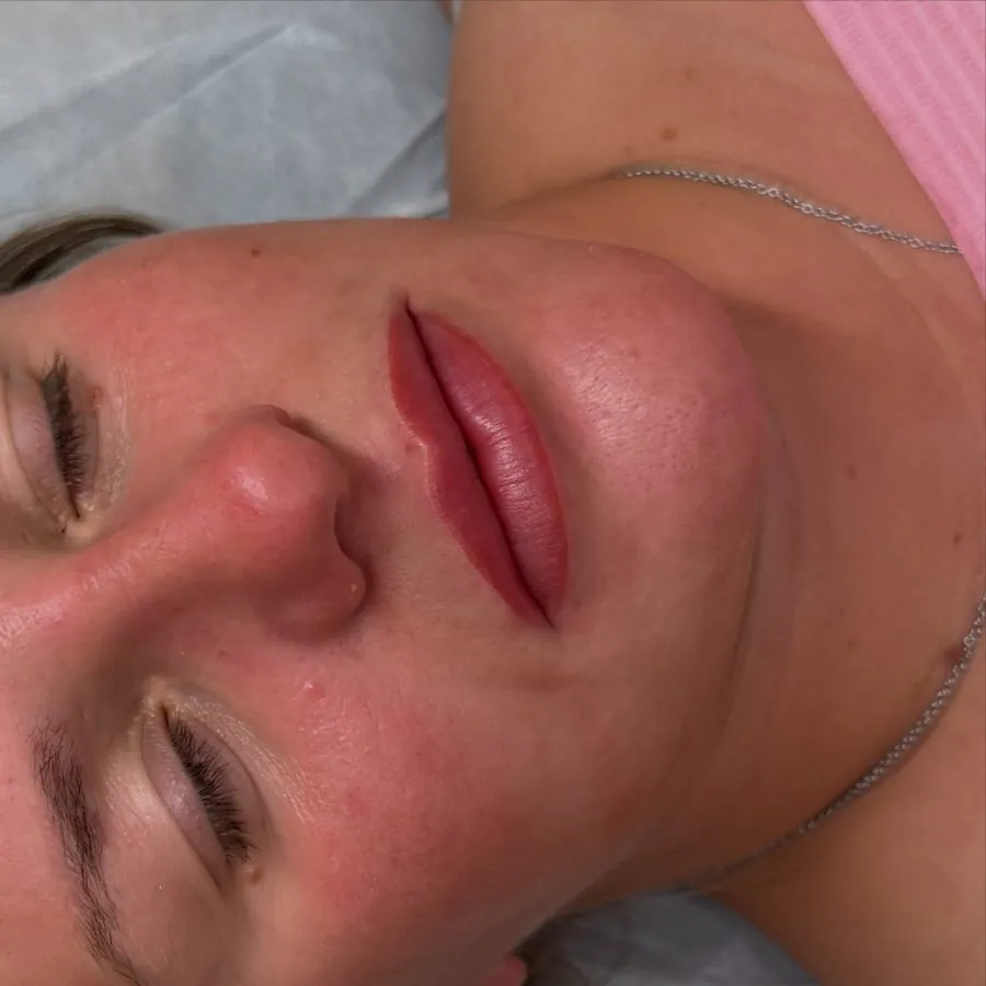 Lip blush during healing